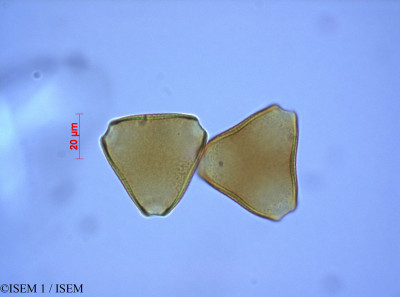 ISEM 1/Mimetes_cucullatus_27559/Mimetes_cucullatus_27559_0001(copy)_thumb.jpg